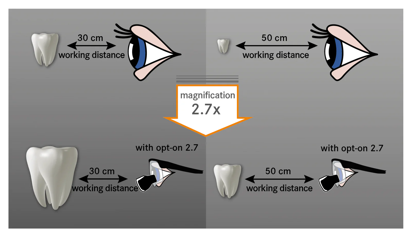 Dental Loupes - Image 5