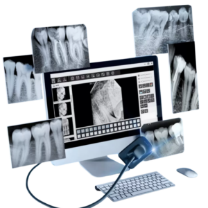 Refine Dental Intraoral X-ray Sensor